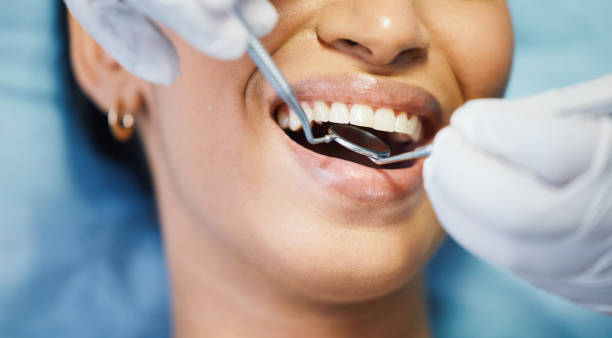 Best Pediatric Emergency Dentist in Avila Beach, CA